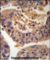 AGXT Antibody (Center)